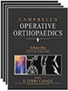 Campbell´s Operative Orthopaedics - Importado