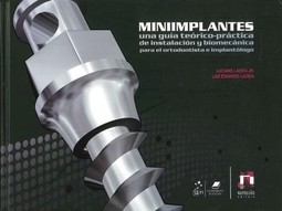 Miniimplantes: una guía teórico-práctica de instalación y biomecánica para el ortodontista e implantólogo