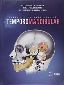 Cirurgia da articulação temporomandibular