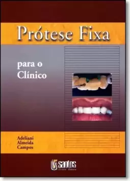 Protese Fixa Para O Clinico