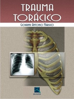 Trauma torácico