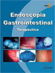 Endoscopia Gastrointestinal: Terapêutica