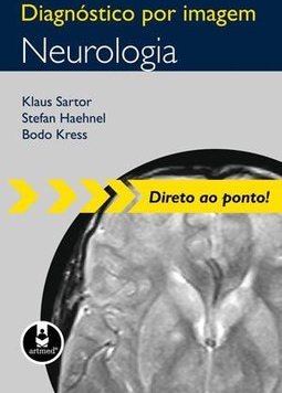 DIAGNOSTICO POR IMAGEM NEUROLOGIA