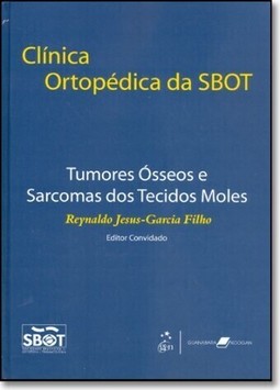 Clinica Ortopedica Da Sbot Tumores Osseos E Sarcomas Dos Tecidos Moles