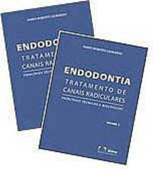 Endodontia: Tratamento de Canais Radiculares