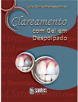 Clareamento com Gel em Despolpado