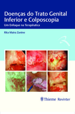 Doenças do trato genital inferior e colposcopia: um enfoque na terapêutica