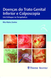 Doenças do trato genital inferior e colposcopia: um enfoque na terapêutica