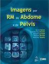 Imagens Por Ressonância Magnética do Abdome e Pelvis