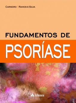 Fundamentos de psoríase