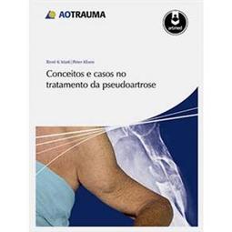 Conceitos e Casos no Tratamento da Pseudoartrose