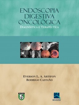 Endoscopia digestiva oncológica: diagnóstica e terapêutica