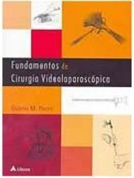 Fundamentos da Cirurgia Videolaparoscópica
