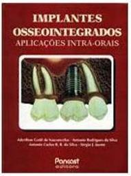 Implantes Osseointegrados: Aplicações Intra-Orais