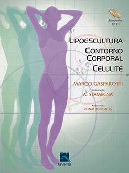 Lipoescultura, contorno corporal, celulite