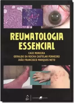 Reumatologia Essencial