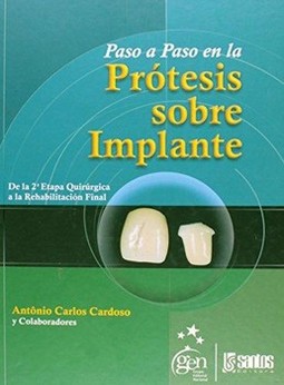 Paso a paso en la protesis sobre implante: de la 2ª etapa quirúrgica a la rehabilitación final
