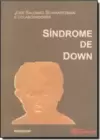 Sindrome De Down