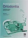 Autoligáveis em Ortodontia