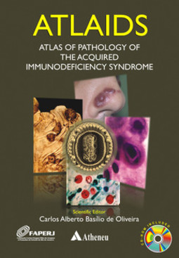 ATLAIDS: atlas of pathology of the acquired immunodeficiency syndrome