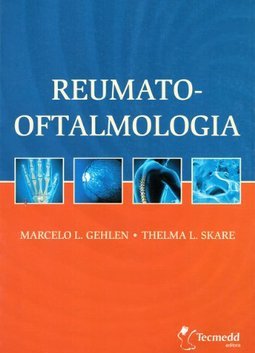 Reumato-Oftalmologia