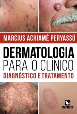 Dermatologia para o clínico: Diagnóstico e tratamento