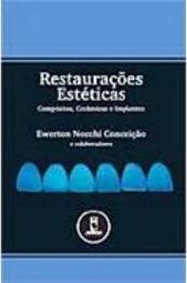 Restaurações Estéticas: Compósitos, Cerâmicas e Implantes