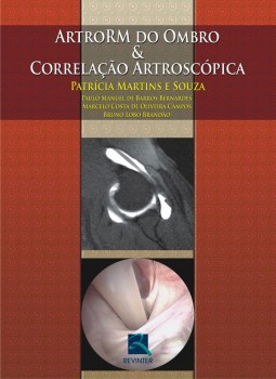 ArtroRM do ombro e correlação artroscópica