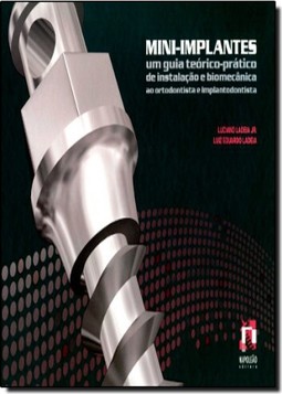 Mini Implantes Um Guia Teorico Pratico De