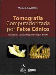 Tomografia Computadorizada por Feixe Cônico