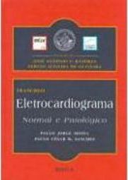 Eletrocardiograma: Normal e Patológico