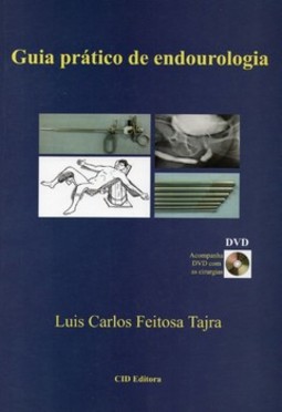 Guia prático de endourologia