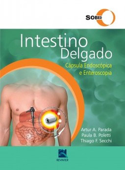 Intestino delgado: cápsula endoscópica e enteroscopia