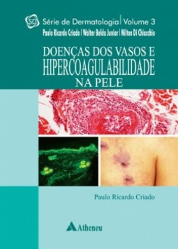 Doenças dos vasos e hipercoagulabilidade na pele