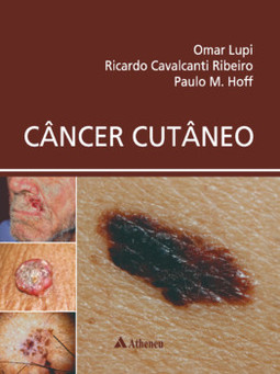Câncer cutâneo