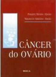 Câncer no Ovário