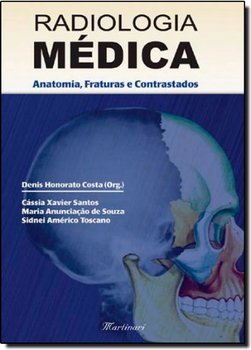 Radiologia Médica: Anatomia, Fraturas e Contrastados