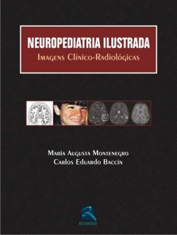 Neuropediatria ilustrada: imagens clínico-radiológicas