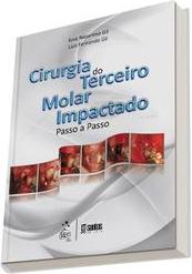 Cirurgia do terceiro molar impactado: Passo a passo