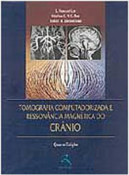 Tomografia Computadorizada e Ressonância Magnética do Crânio