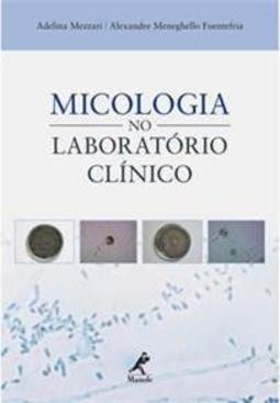 Micologia no laboratório clínico