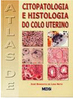 Atlas de Citopatologia e Histologia do Colo Uterino
