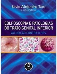 Colposcopia e Patologias do Trato Genital Inferior