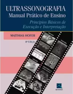 Ultrassonografia