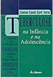 Tuberculose na infância e na adolescência