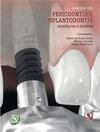Avanços em Periodontia e Implantodontia