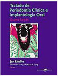 Tratado de Periodontia Clínica e Implantologia Oral