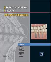 Especialidades em imagens: implantes dentários