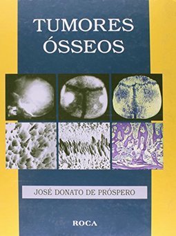 Tumores Ósseos