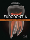 Endodontia: princípios para prática clínica